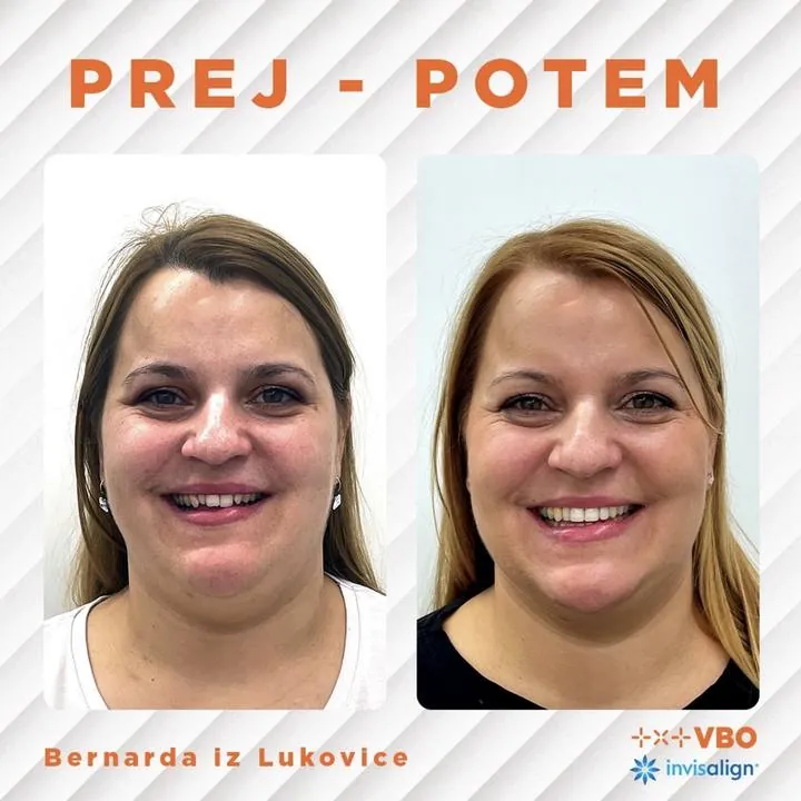 Instagram zgodba — Pacient VBO