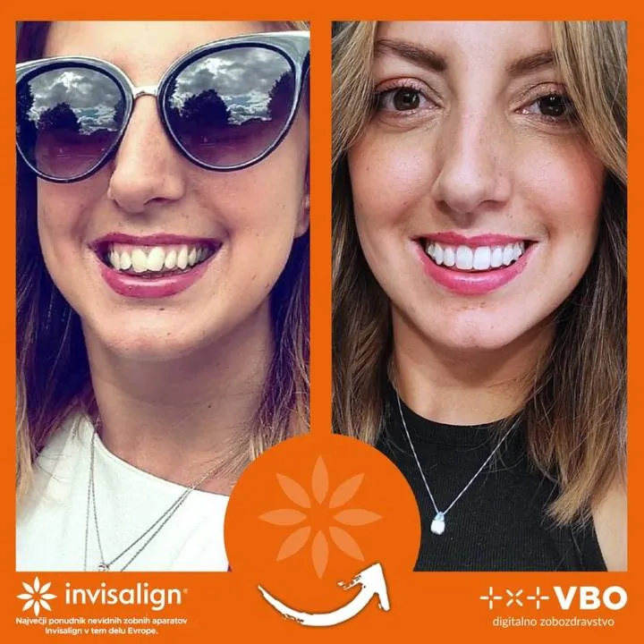 Instagram zgodba — Pacient VBO