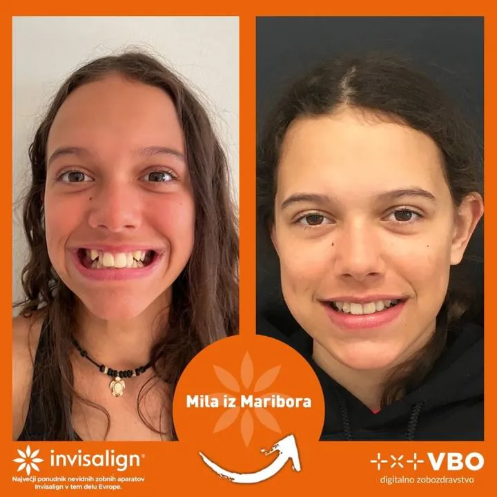 Instagram zgodba — Pacient VBO