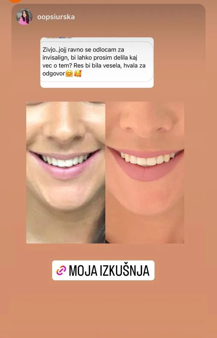 Instagram zgodba pacienta VBO