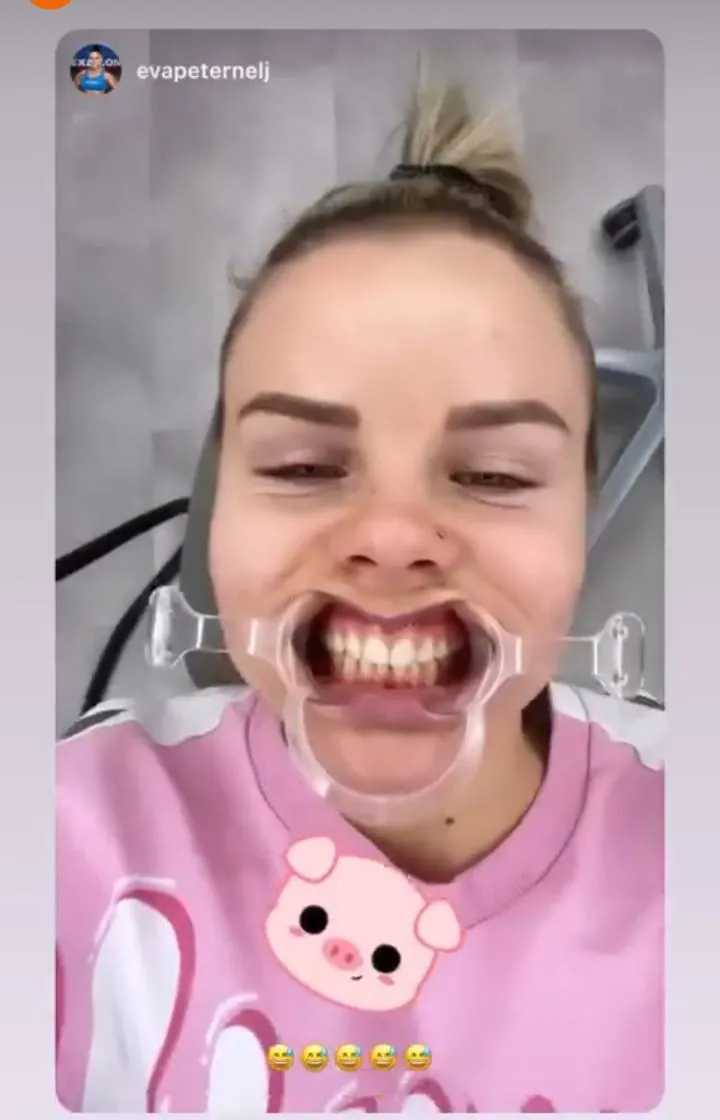 Instagram zgodba pacienta VBO