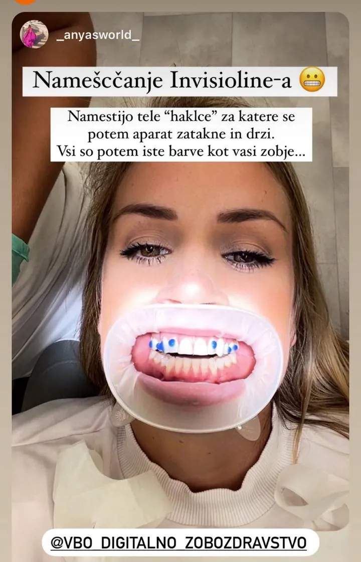 Instagram zgodba pacienta VBO