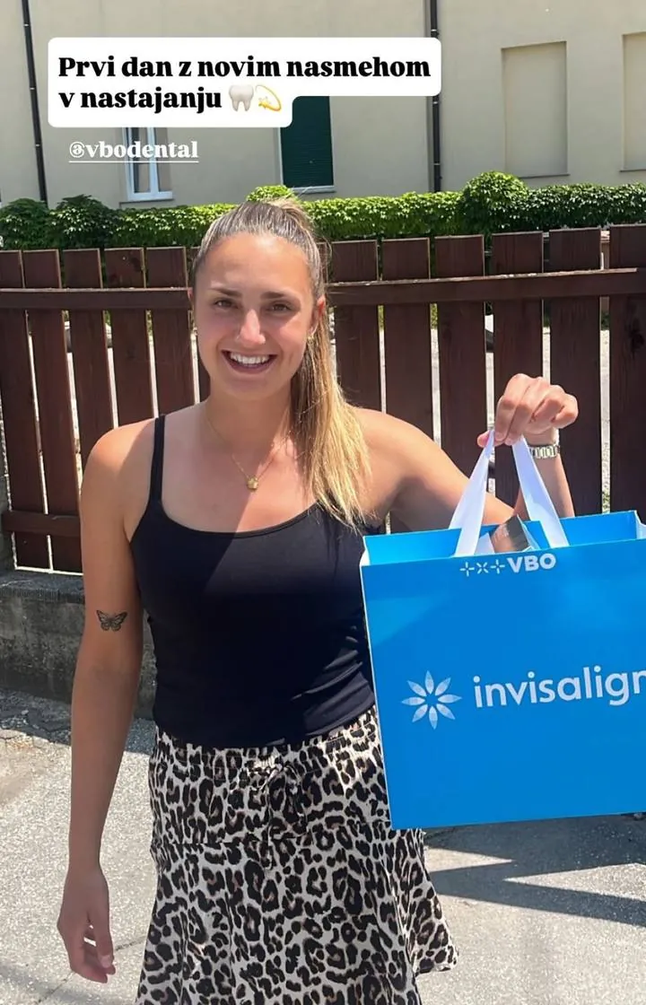 Instagram zgodba pacienta VBO o poravnavi z aparatom Invisalign