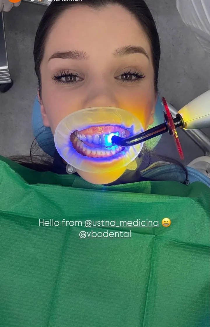 Instagram zgodba pacienta VBO o poravnavi z aparatom Invisalign