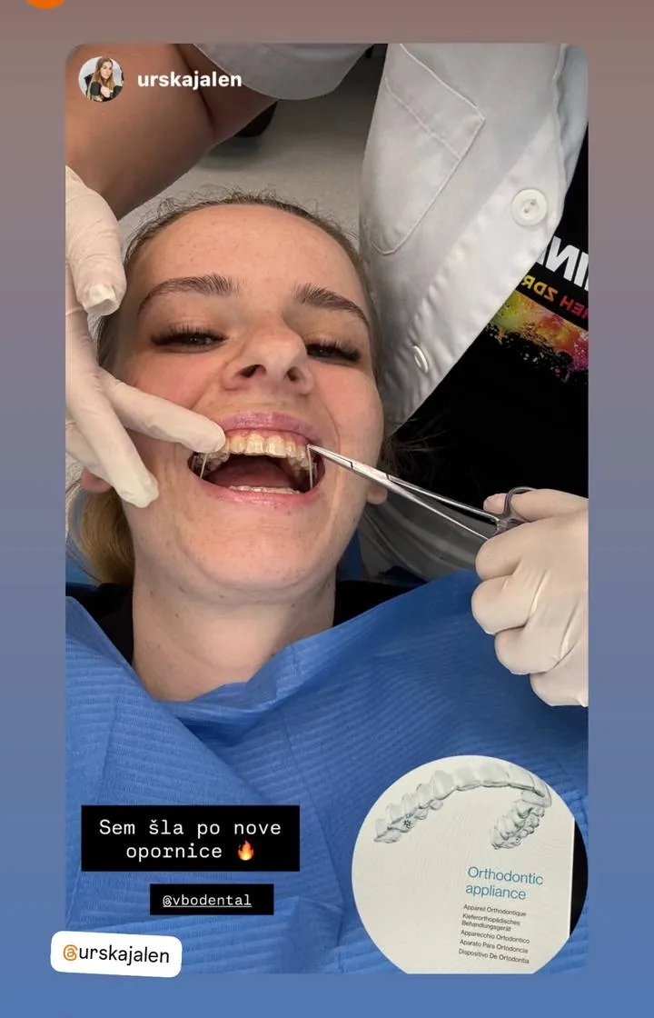 Instagram zgodba pacienta VBO o poravnavi z aparatom Invisalign
