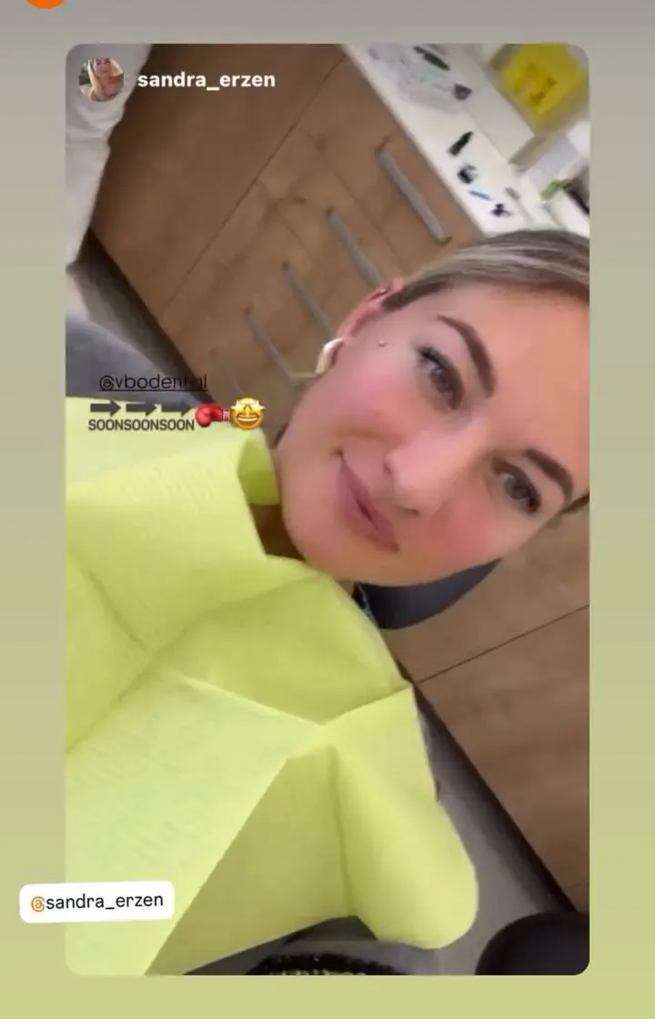Instagram zgodba pacienta VBO o poravnavi z aparatom Invisalign