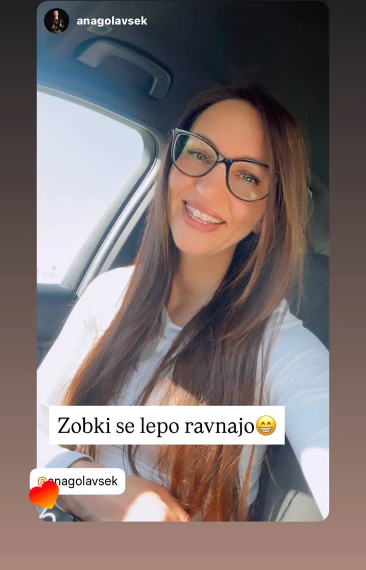 Instagram zgodba pacienta VBO o poravnavi z aparatom Invisalign