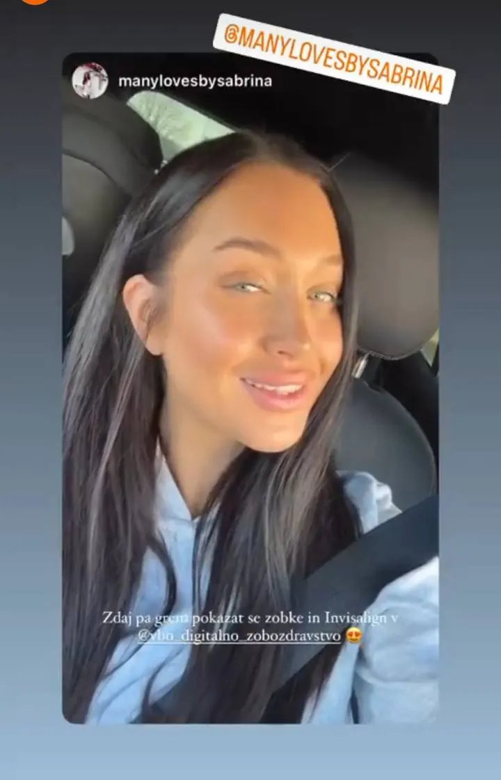 Instagram zgodba pacienta VBO o poravnavi z aparatom Invisalign