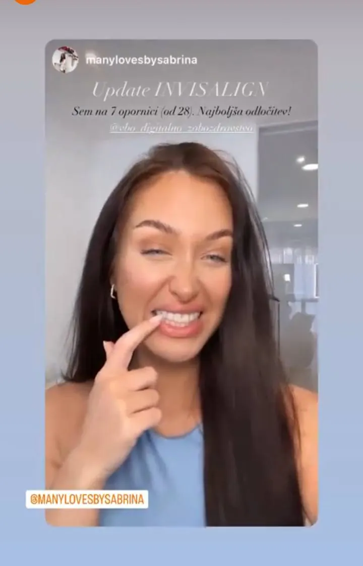 Instagram zgodba pacienta VBO o poravnavi z aparatom Invisalign