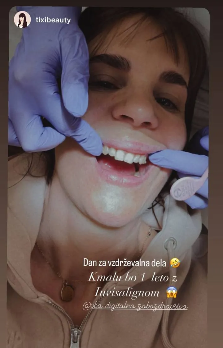 Instagram zgodba pacienta VBO o poravnavi z aparatom Invisalign